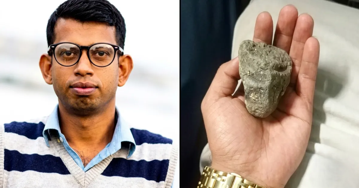 ট্রেনে ছোড়া পাথরে এক চোখ হারালেন আইনজীবী
