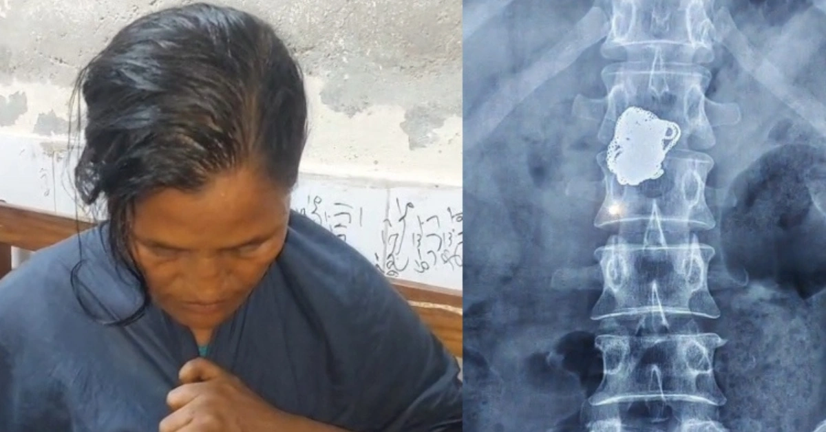 নোয়াখালী হাসপাতালে স্বর্ণের চেইন চুরির পর আটক সিনারা বেগম